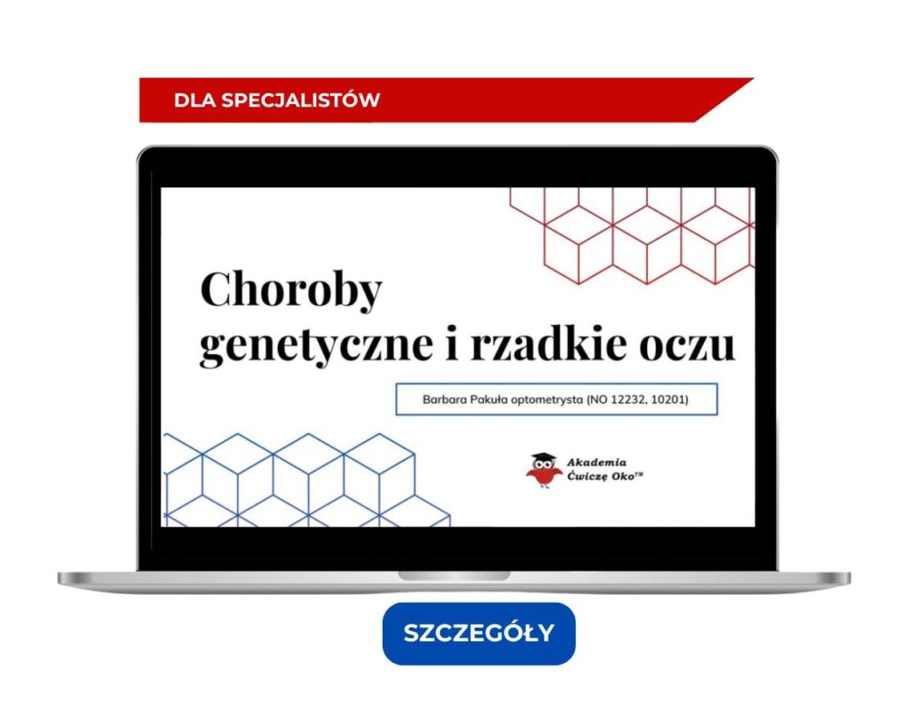 ćwicze oko